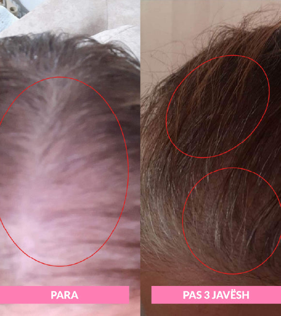 Daily Superhair